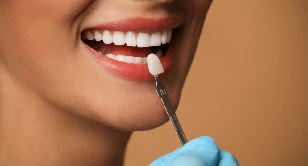 Porcelain crown and bridge restorations at Family Dental Care in Leavenworth, KS