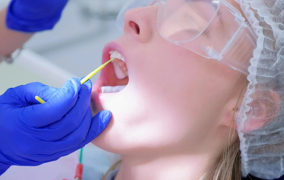 Professional fluoride varnish at Family Dental Care in Leavenworth, KS