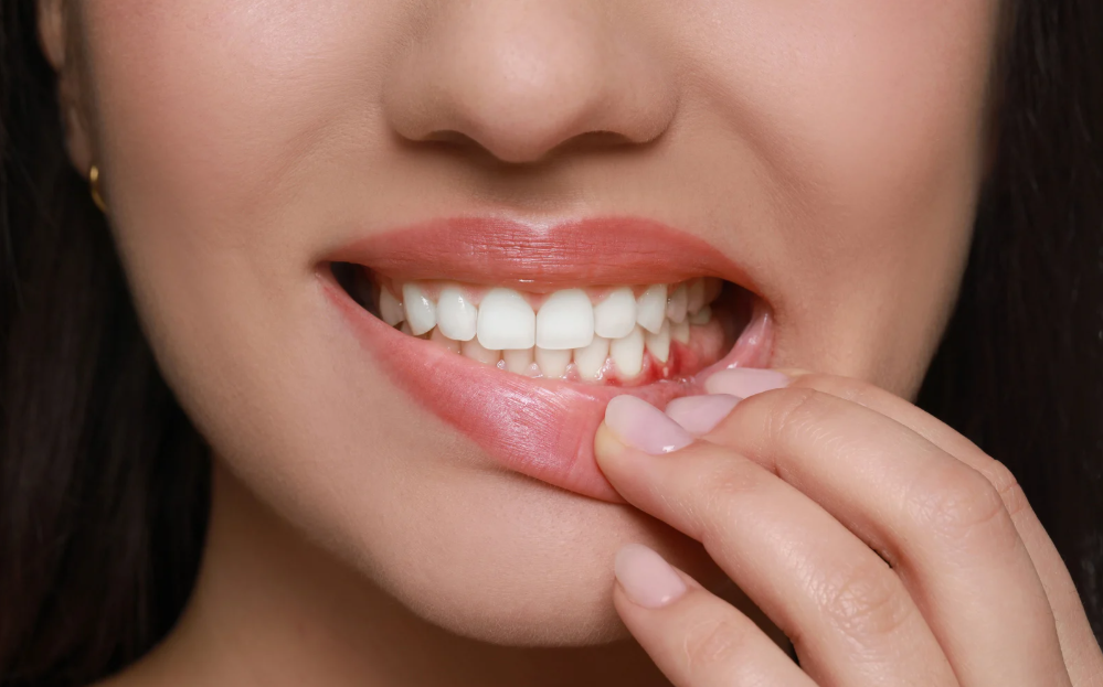Gum disease treatment and healthy gums at Family Dental Care in Leavenworth, KS