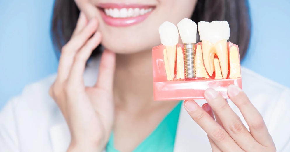 Dental implant tooth replacement at Family Dental Care in Leavenworth, KS