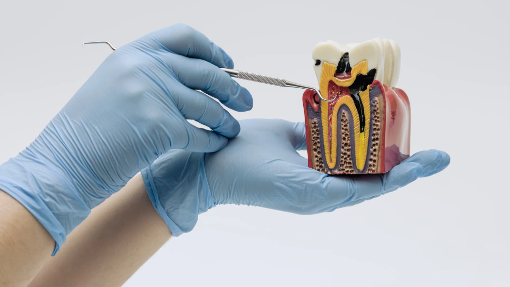 Modern root canal treatment at Family Dental Care in Leavenworth, KS
