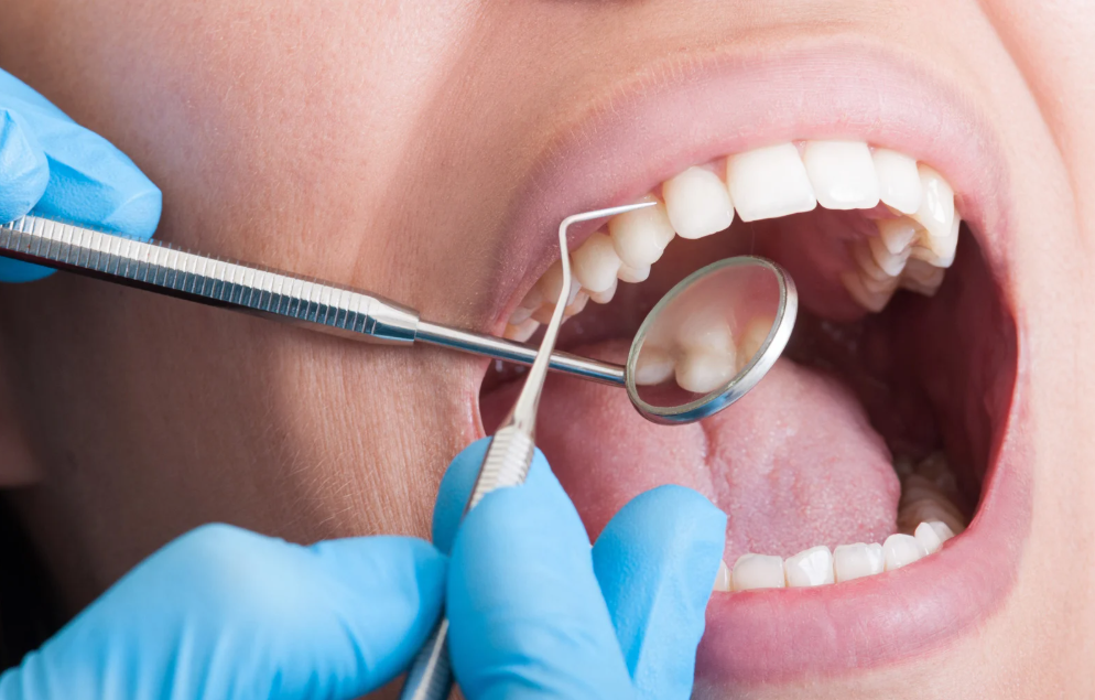 Professional teeth cleaning in Leavenworth, KS at Family Dental Care
