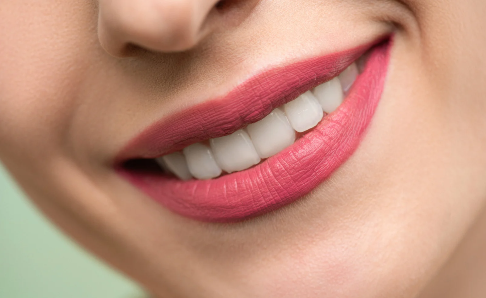 Professional whitening and take-home kits at Family Dental Care in Leavenworth, KS