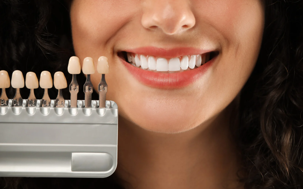 Professional teeth whitening in Leavenworth, KS at Family Dental Care
