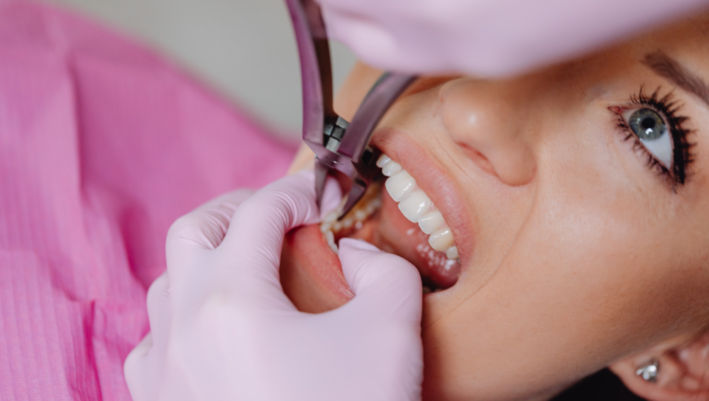 Tooth extraction and aftercare at Family Dental Care in Leavenworth, KS