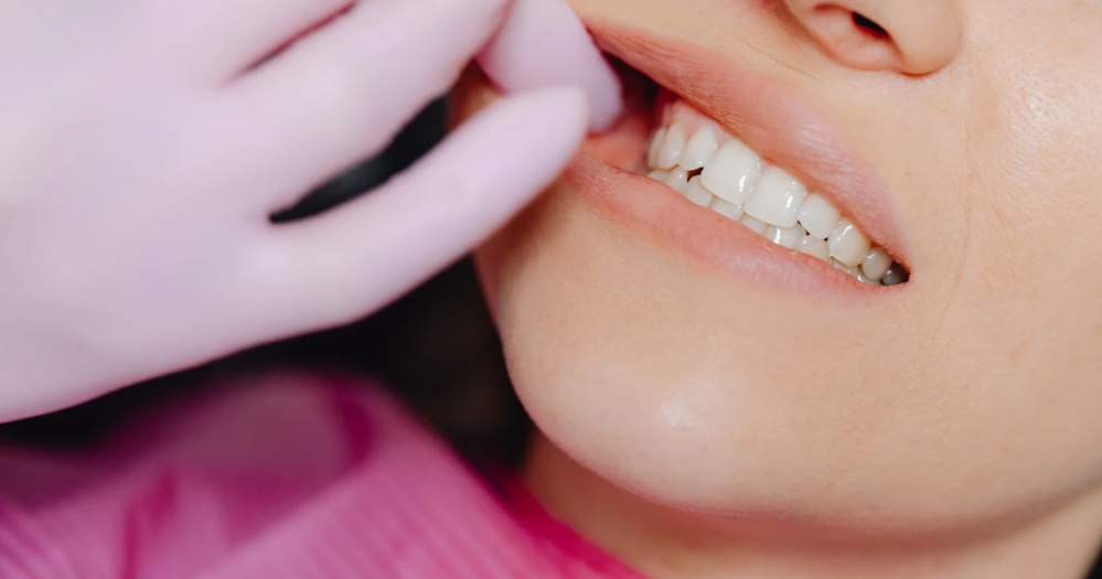 Wisdom teeth evaluation and removal in Leavenworth, KS at Family Dental Care